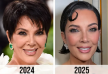 kris jenner face lift