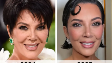 kris jenner face lift