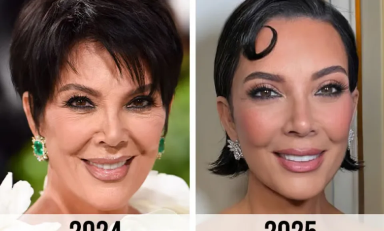 kris jenner face lift